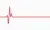 EKG